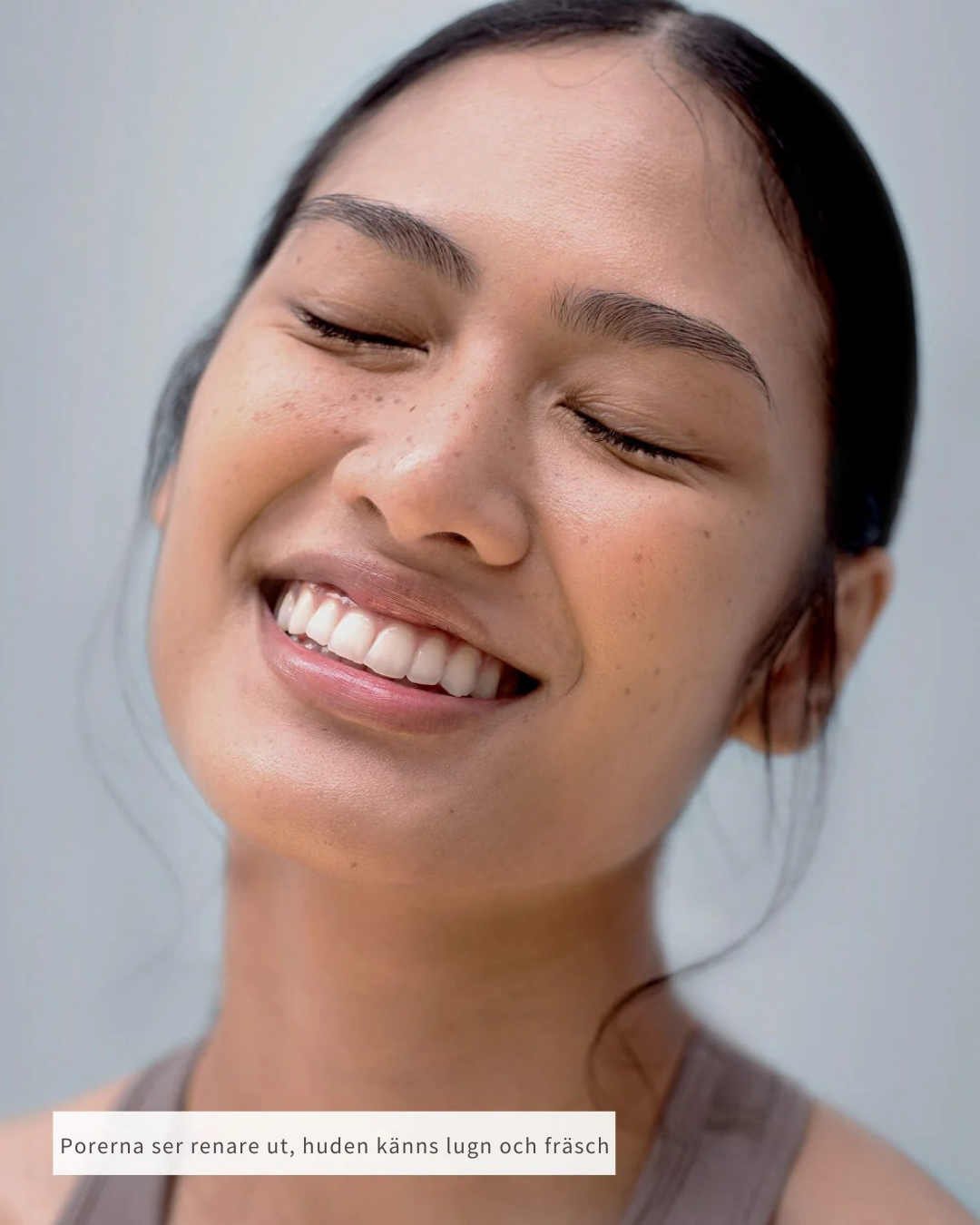 Nose Patches™ – Din väg till rena, fria porer